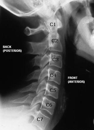 C6 Xray