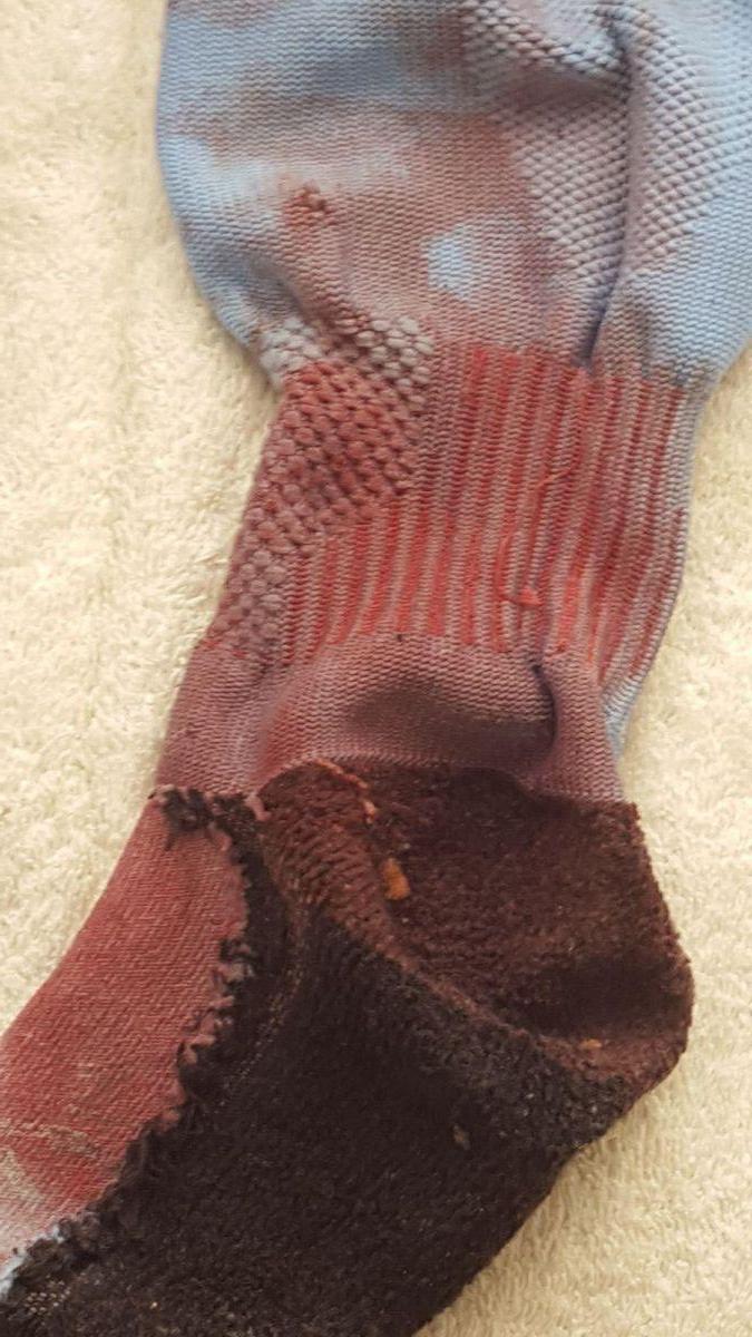 Closeup Tog's Sock